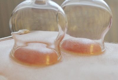cupping massage